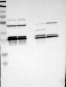 NBP1-89827 - 14-3-3 protein epsilon